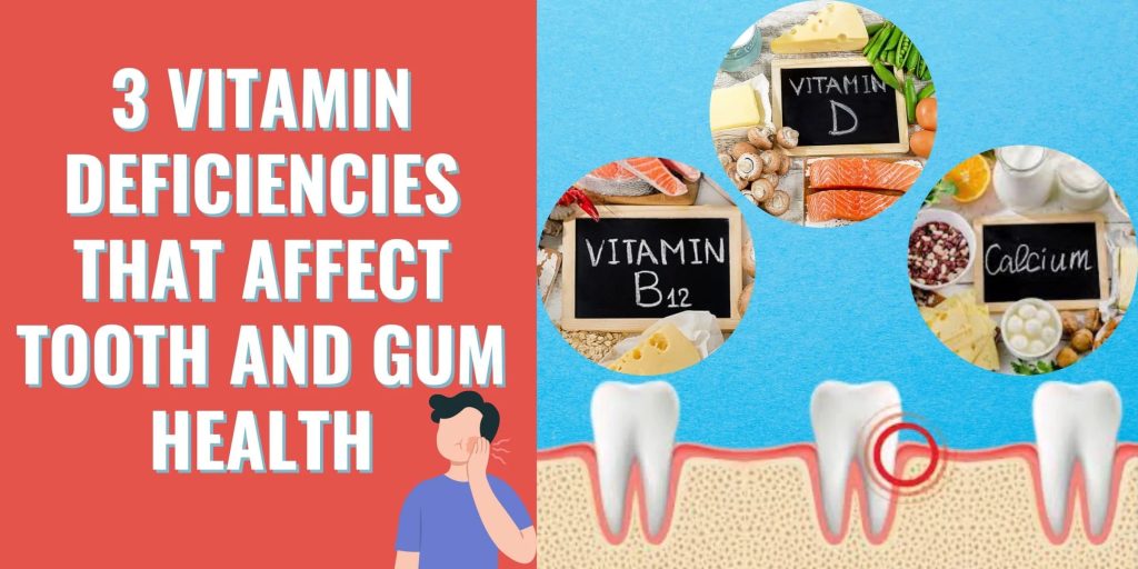 best vitamins for teeth and gums