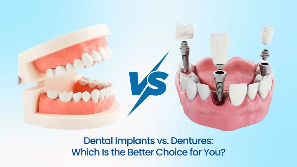 dentures vs implants